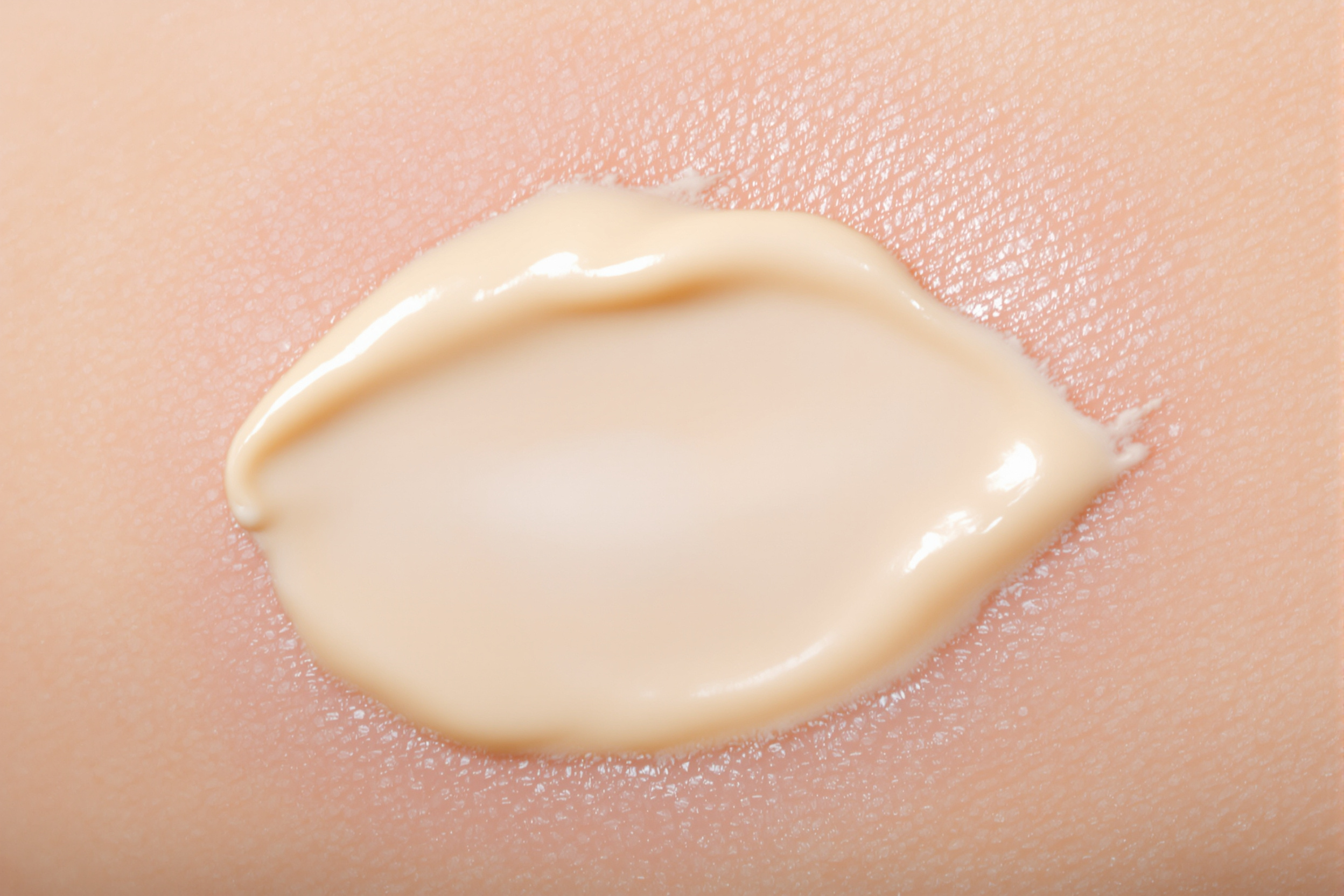 Application d'une crème naturelle sur peau avec psoriasis