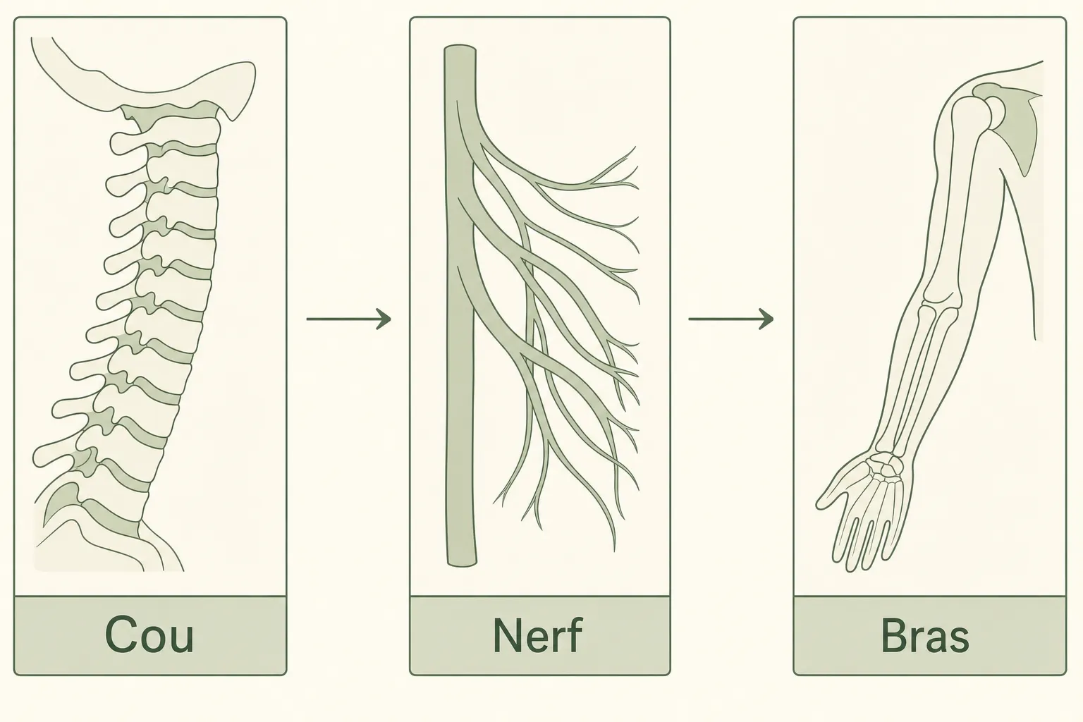 Schéma montrant l’évolution de la douleur épaule cou: colonne cervicale, plexus nerveux et bras.